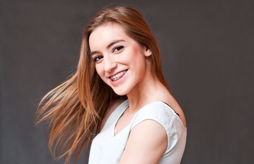 Braketlerle Guzel Fotograf Vermenin Sirlari braket uzmani Dr ozlem aylikci ortodonti uzmani seffaf plak uzmani invisalign uzmani invisalign provider invisalign teen provider