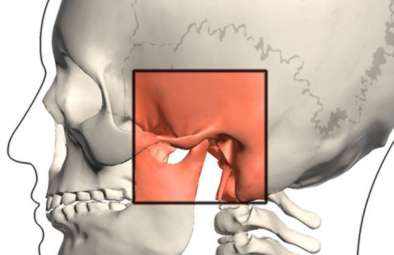 Çene Eklemi İle İlgili Bilmeniz Gereken Her Şey Eklem Hastalıkları İçin Tedavi Seçenekleri Nelerdir?​ Ortodonti uzmanı Dr. Özlem Aylıkcı