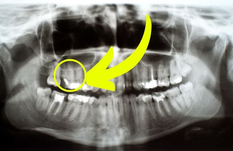 Dr ozlem aylikci ortodonti uzmani seffaf plak uzmani invisalign uzmani kirik dis