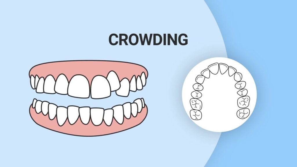 Ortodontik problemleri nasıl anlarız