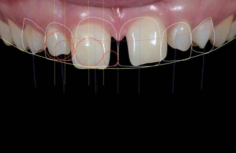 Dr. ozlem aylikci Drozlemorto Gulus tasarim uzmani dr. Bahadir Ugur Aylikci Smile Design