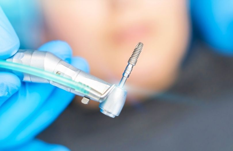 yabancı implantlar implant fiyatları yerli implantlar