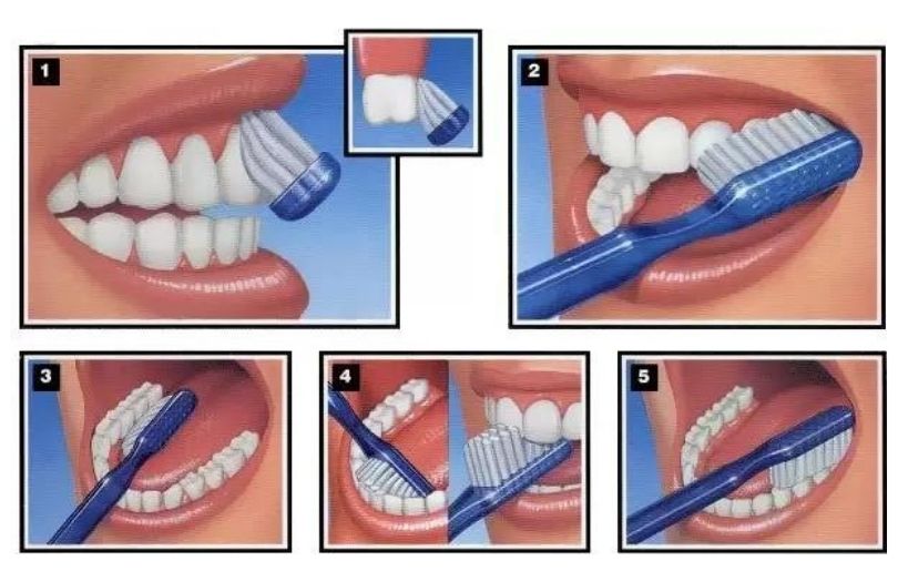 Gunluk Dis Bakimi Nasil Olmali Dr Bahadir Ugur Aylikci lamine Uzmani Implant Uzmani Dis eti Uzmani Periodontoloji Uzmani