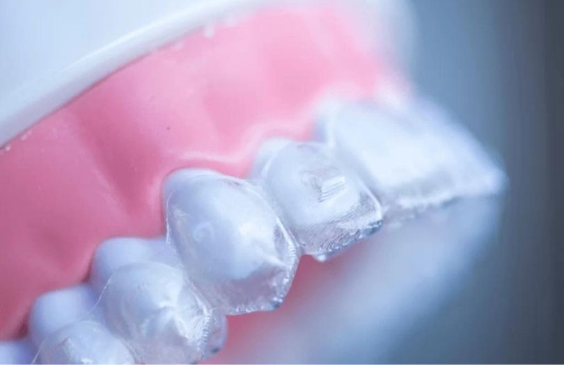 atacman Dr ozlem aylikci ortodonti uzmani seffaf plak uzmani invisalign uzmani invisalign provider