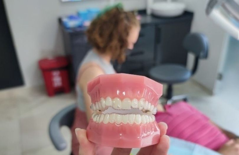 Invisalign Şeffaf Plak Invisalign First, Çocuklarda Invisalign Paketi Invisalign Zor Vaka Paketi Hastaları tedavilerimiz